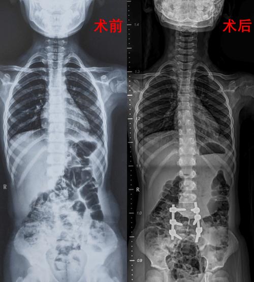 西安x光片扫描