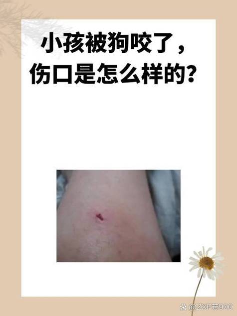 被自己家狗咬了