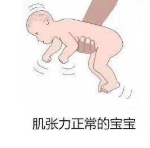 降低肌张力的六种方法图标