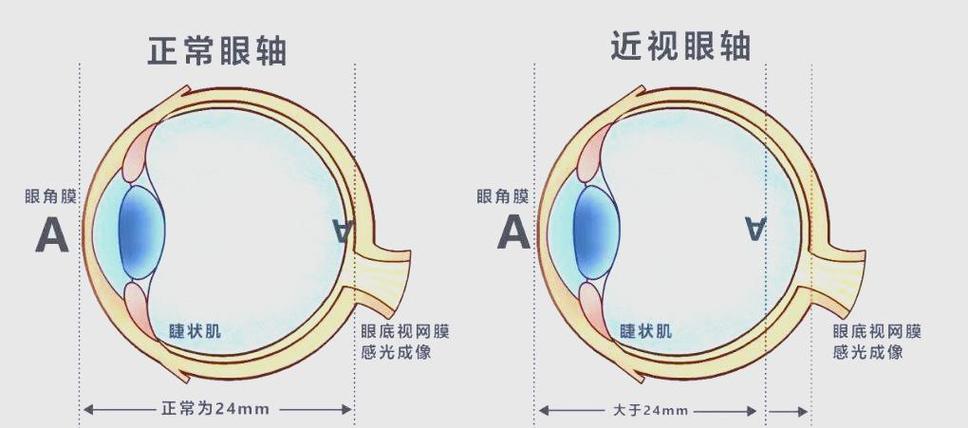 反转拍训练一年后效果