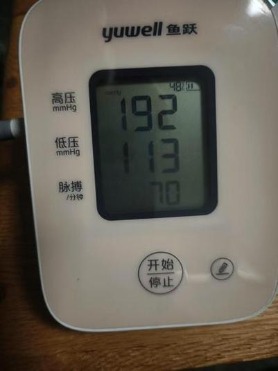 一看到血压计就紧张,血压很高