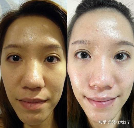 女生脸色暗黄怎么调理截图
