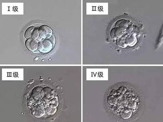 一级融合胚胎好吗