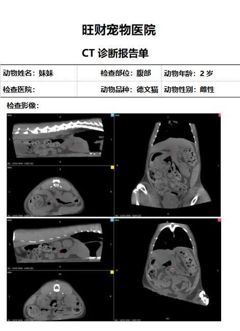 拍ct的拍摄技巧