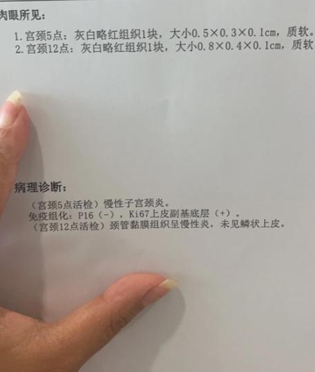 未见明显血流信号是什么意思