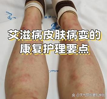穿二手衣服会得艾滋病吗图标