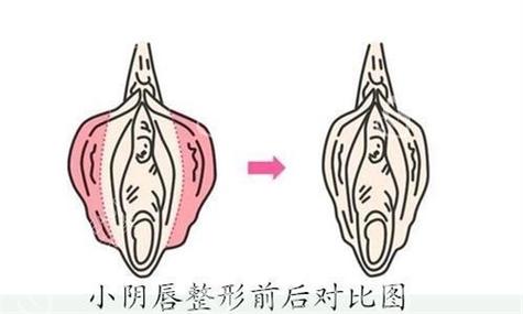 私密整形前后对比