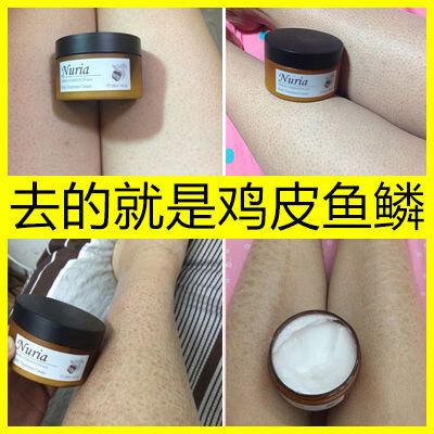 身体乳可以去鸡皮肤吗
