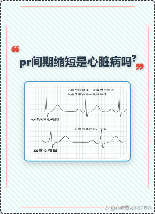 短pr间期是什么意思严重吗截图