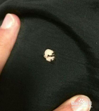 裤子烧个洞怎么补救
