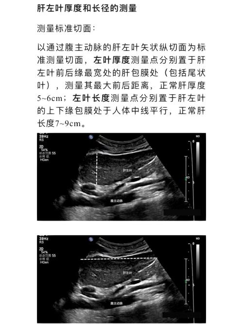 正常肝界的大小