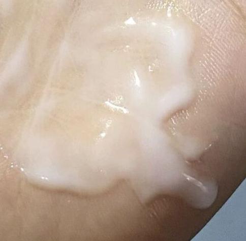 女生12岁内裤上总有白色分泌物