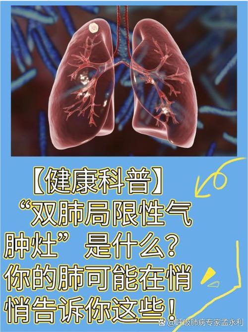 apo医学上的意思