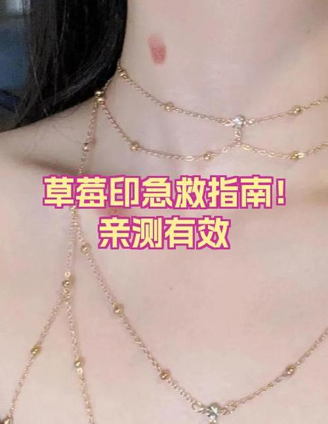 草莓印一夜消失窍门