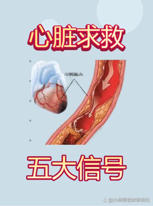 心脏求救6个信号