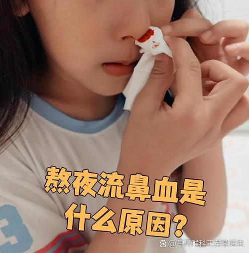 熬夜后突然流鼻血截图