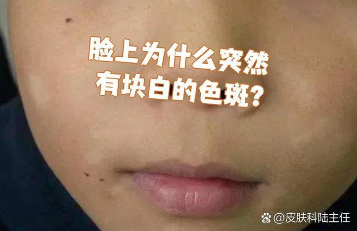 为什么会突然变白