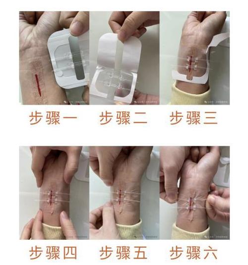 去除胶布留下的疤痕的方法