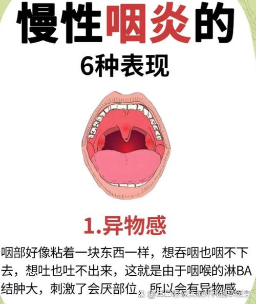 唱歌感觉喉咙堵着打不开