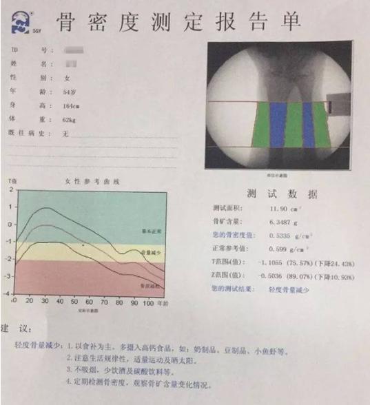 骨密度正常值范围是多少