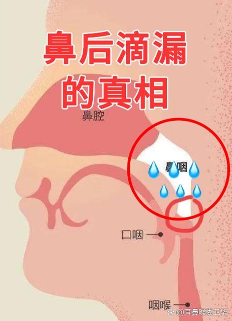 闻到香味就咳嗽怎么回事