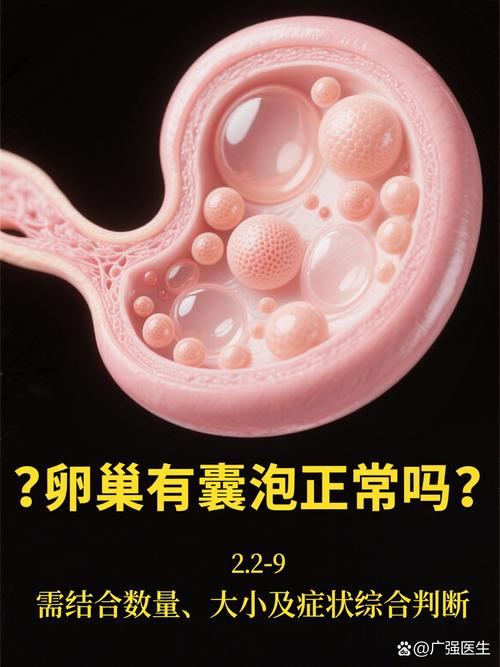 卵巢有囊泡正常吗