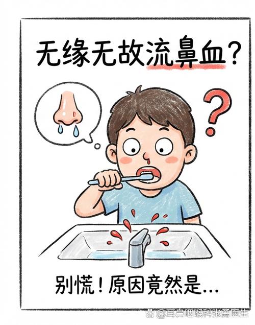 为什么会无缘无故流鼻血