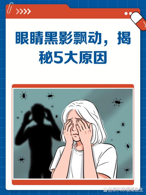 眼前有黑影挂眼科什么科截图