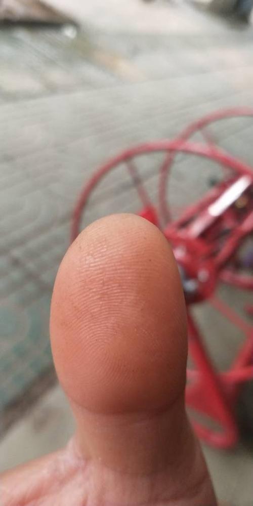 指纹毁了还能恢复吗
