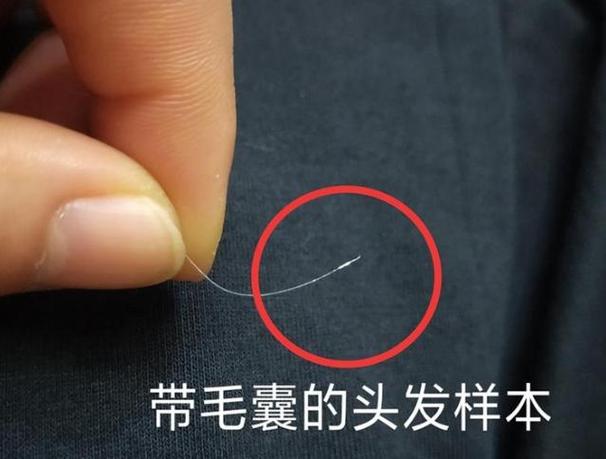 头发dna检测一次多少钱截图