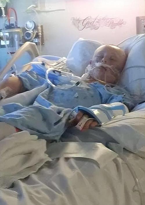 脑死亡后活了4年