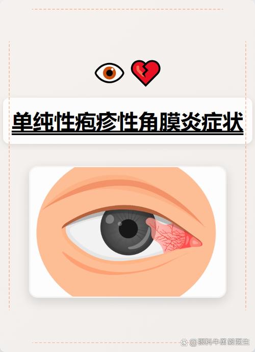 眼睛模糊是癌症的早期信号吗