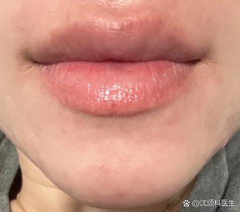 天生自带口红的嘴唇