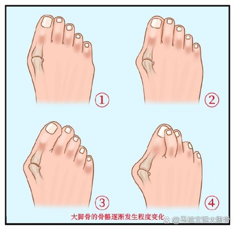 大脚怎么显示治疗量