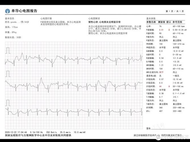 医学上ecg代表什么意思