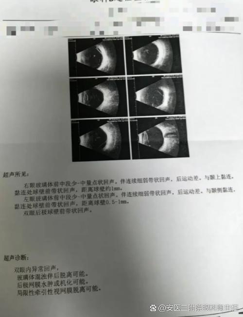 监控画面一闪一闪的原因是什么
