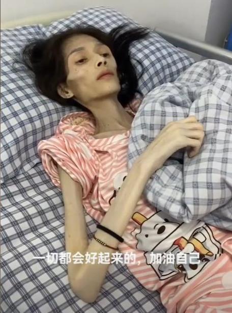 抑郁厌食症的初期症状有哪些