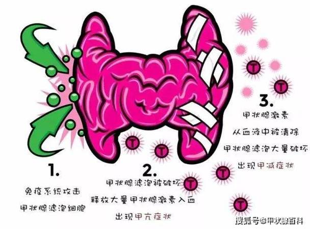 tsh12.5多久会癌变