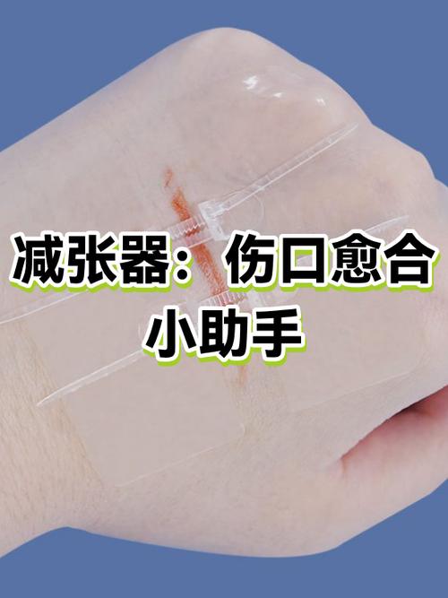 伤口缝合几天拆线图标