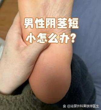 阳短