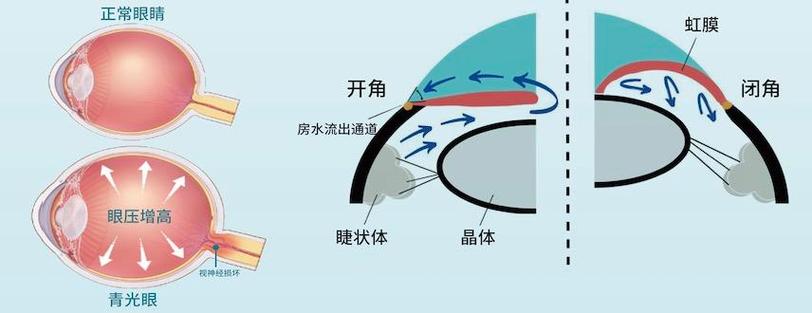 视野缺失可以恢复吗