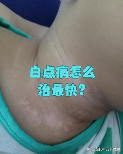 ipad的白点怎么调出来游戏截图