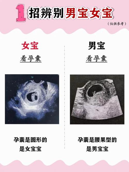 怎么辨别男孩女孩图标