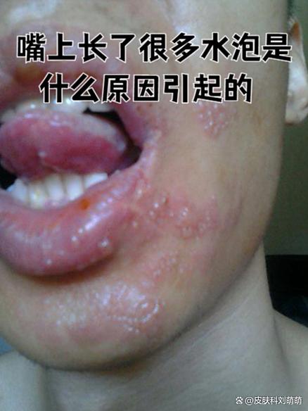 异鬼2病毒是什么