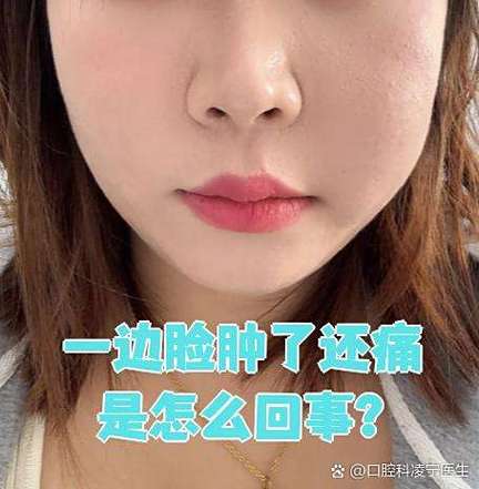 牙疼一边脸肿是怎么回事
