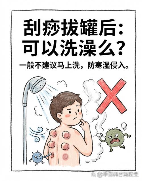 刮痧之后不能洗澡吗