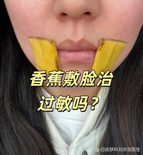 过敏香蕉敷脸的功效与作用截图