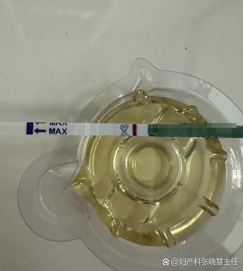 一个红一个不明显是怀孕了吗