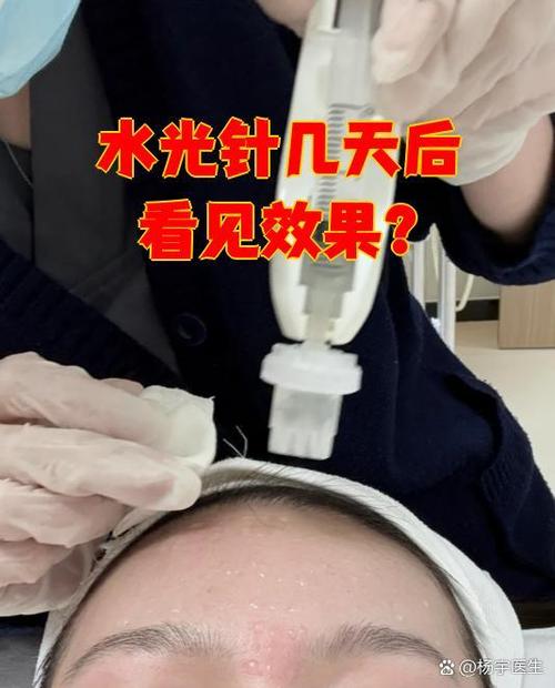 打完水光10天了没效果