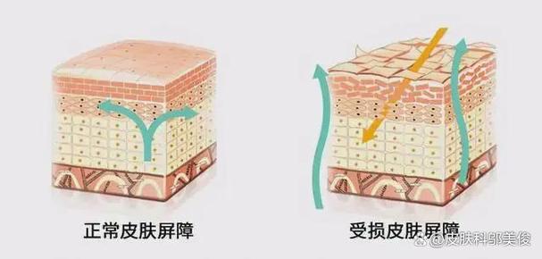 皮肤受损修复小妙招图标